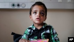 Marwan Hassanein, 4, gets a gift for Eid at Shifa Hospital in Gaza City, where he’s being treated for shrapnel wounds to his head July 28, 2014.