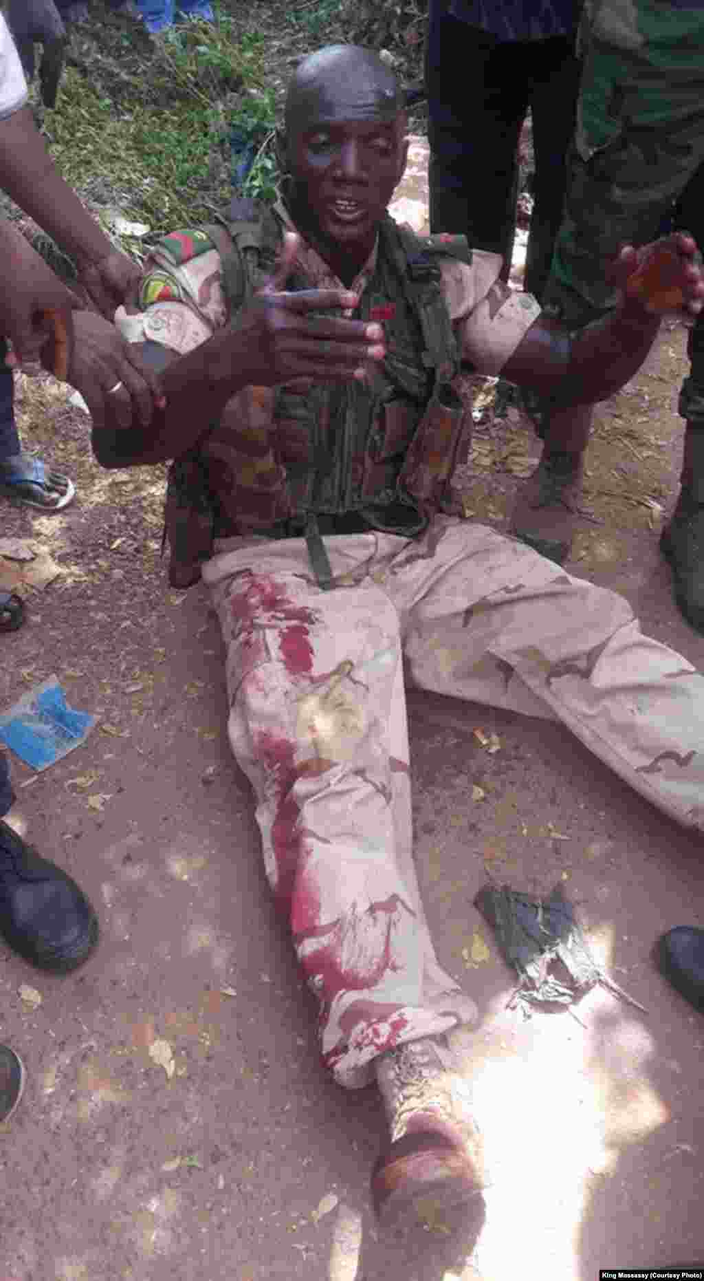 Un soldat malie blessé lors de l'assaut à l'hôtel Radisson, Bamako, Mali, 20 novembre 2015. Crédit King Massassy