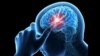 ผู้เชี่ยวชาญชี้ว่า 'การฟื้นฟูร่างกายจากอาการบาดเจ็บ' เกี่ยวข้องกับการทำงานของสมอง