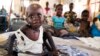 Khủng hoảng suy dinh dưỡng trẻ em tại Nam Sudan 