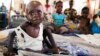 Child Malnutrition Crisis Deepens in South Sudan