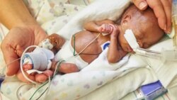 Quiz - Artificial Womb May Help Smallest Babies