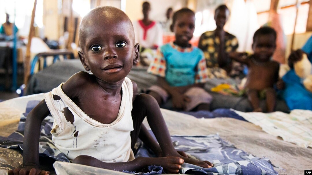 Salah satu fasilitas medis kelompok MSF untuk merawat anak-anak yang menderita kurang gizi parah di Sudan Selatan (foto: ilustrasi). 