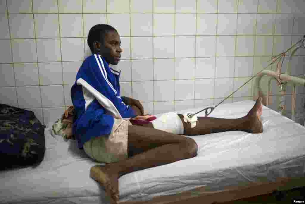 Issaka Hamidou, 16, recovers in an hospital from a stray bullet wound inflicted during the continuing sectarian violence in Bangui, Feb. 3, 2014.