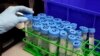 ﻿زن مبتلا به ویروس اچ‌آی‌وی در نیویورک با روش نوین پیوند سلول‌های بنیادی درمان شد