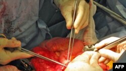 Tayvanda HİV-ə yoluxmuş xəstədən beş adama orqan transplantasiyası edilib