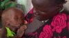 Thousands of South Sudan Children to be Screened for Malnutrition