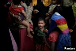 A baby cries as Rohingya refugees line up for a food supply distribution at the Kutupalong refugee camp near Cox's Bazar, Bangladesh Dec. 12, 2017.