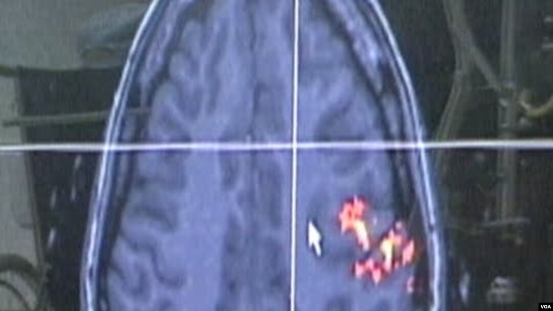 Penelitian pada otak untuk penyakit Alzheimer atau pikun.