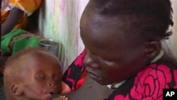 A malnourished child is fed by her mother in a Medecins Sans Frontiers (Doctors Without Borders) hospital, in Leer, South Sudan. The Associated Press image was taken on Tuesday, May 13, 2014. 