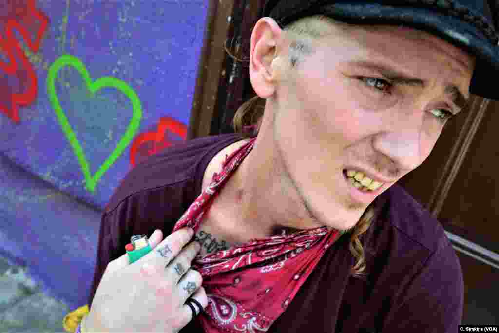 Davey points to where he injects heroin in the vein on the side of his neck.