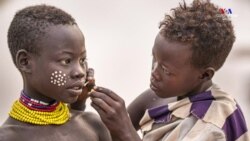 Ի՞նչն է կարևոր լուսանկարչության համար