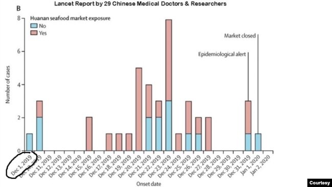 《柳叶刀》今年1月刊载的文章显示，中国的零号病人在2019年12月1日发病。(图片由“洛杉矶视觉艺术家协会”提供)
