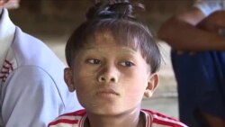 စက်စက်ယိုရွာက ဆံရစ်ဝိုင်းလေးများ