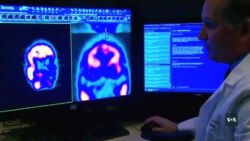 Американські науковці працюють над розробкою революційного методу тестування струсу мозку. Відео