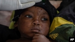 Emile Miango, 2, who has mpox, lies in the hospital, on Sept. 4, 2024, in Kamituga, South Kivu province, which is the epicenter of the world’s latest outbreak of the disease in eastern Congo.