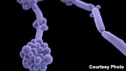 U.S. public health officials are urging doctors and nurses around the world to be on the lookout for a highly drug-resistant yeast strain called Candida auris. (Photo courtesy of CDC)