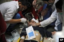 Na ovoj fotografiji koju je objavila sirijska državna agnecija SANA, vidi se čovek koji prima pomoć u bolnici u Damasku, Sirija, 7. aprila 2018. Državna televizija javlja da su borci Armije islama gađali nekoliko oblasti u Damasku minobacačkim granatama.