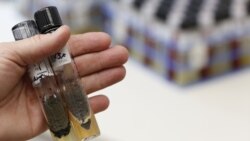 Las infecciones de tipo fúngica no son contagiosas ni se transmiten de persona a persona sin embargo pueden causar la muerte