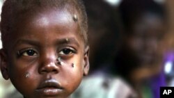 A starving child is covered with flies at the pediatric malnutrition ward at the Lilongwe Central Hospital, Malawi, April 24, 2002.