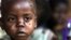 A starving child is covered with flies at the pediatric malnutrition ward at the Lilongwe Central Hospital, Malawi, April 24, 2002.