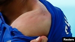 Italy's Giorgio Chiellini shows his shoulder, claiming he was bitten by Uruguay's Luis Suarez, during their 2014 World Cup Group D soccer match at the Dunas arena in Natal, June 24, 2014.