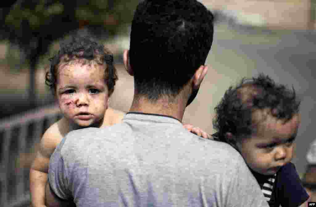 A Palestinian man holds his daughters, Shada and Lama al-Ejla, who were injured in an Israeli tank attack, as he leaves al-Shifa hospital in Gaza City, July 18, 2014. 