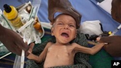 Menurut badan bantuan kesehatan Dokter Tanpa Tapal Batas (MSF), Republik Afrika Tengah bukan hanya mengalami krisis kekurangan gizi parah, tetapi juga tingkat kematian anak-anak yang tiga kali lebih tinggi dari tingkat darurat (foto: dok).