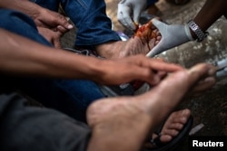 Migrants receive medical attention for blisters in theTapachula city center, Mexico, Oct. 21, 2018.