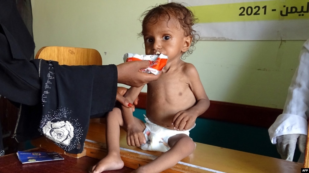 FILE - A Yemeni woman feeds a malnourished child at a clinic in the war-ravaged western province of Hodeidah, Aug. 7, 2021.