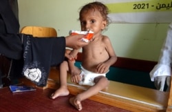 FILE - A Yemeni woman feeds a malnourished child at a clinic in the war-ravaged western province of Hodeidah, Aug. 7, 2021.