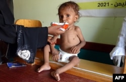 FILE - A Yemeni woman feeds a malnourished child at a clinic in the war-ravaged western province of Hodeidah, Aug. 7, 2021.