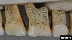 Right upper teeth of an individual of the newly identified species Homo luzonensis, found in Callao Cave on Luzon Island, the Philippines, are seen in this undated handout photo obtained by Reuters April 10, 2019. 