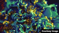 A scanning electron micrograph shows HIV particles infecting a human H9 T cell, colorized in blue, turqoise, and yellow. (Credit: NIAID)