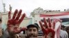 یمن: سکیورٹی فورسز کی مظاہرین کے ساتھ جھڑپیں، 20 ہلاک