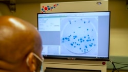 FILE - Sandile Cele, a researcher at the Africa Health Research Institute in Durban, South Africa, works on the omicron variant of the COVID-19 virus, Dec. 15, 2021.