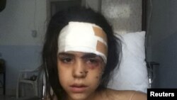 ံHoms ဒေသနားရှိ Houla ဆေးရုံတွင် ဆေးကုသမှုခံယူနေသည့် ဗုံးဒဏ်ကြောင့် ဒဏ်ရာရခဲ့သူ မိန်းကလေးငယ်တဥိး။ ဇူလိုင် ၁၇၊ ၂၀၁၂