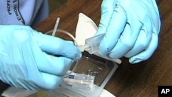 Rapid HIV screening test