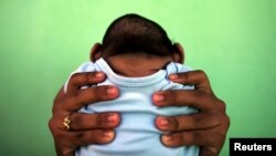 El Zika ha causado alarma en el continente americano desde que se descubrieron casos de microcefalia en Brasil, el país más afectado por el brote del virus.