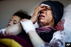 FILE - Aida, 32, reacts as she recovers from severe injuries after the Syrian Army shelled her house in Idlib north Syria.