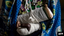 Alphonsime Mojetha (54) recovers in a hospital room, March 2, 2018 in Bunia, DRC, after an attack on her village where she lost her two children, and received severe lacerations to the back of her head, arms and hands from a machete attack.