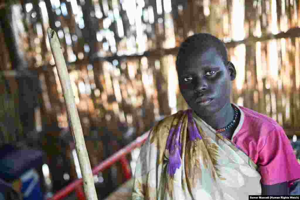 Physically disabled Angelina, 20, was left behind when members of a militia allied with the South Sudan army abducted three women and a teenage girl that she was hiding with. “When I fled [my village], I felt very tired and I sometimes would fall and have