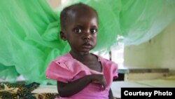 A malnourished girl in Malawi.
