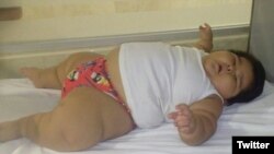 اضافه وزن لوئیس مانوئل گونزالس، ۱۰ ماهه، تیم پزشکی را به حیرت آورده است. عکس از: @SickChirpse