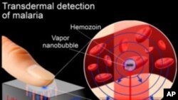 Un scanner au laser (AP)