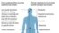Symptoms associated with Havana syndrome, which has affected Americans serving at diplomatic posts in several countries. (AP Graphic)