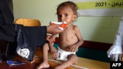 FILE - A Yemeni woman feeds a malnourished child at a clinic in the war-ravaged western province of Hodeidah, Aug. 7, 2021.