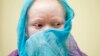 Moçambique: Rapto de albinos continua em Tete