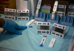 Laboratory technicians test a blood sample for HIV infection at the Reproductive Health and HIV Institute (RHI) in Johannesburg, Nov. 26 2020.