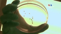 SHORT VIDEO: Մարդու ուղեղի աճեցված մասնիկները